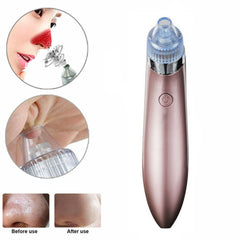 Electric Blackhead Remover Pore Vacuum Suction Diamond Dermabrasion Face Cleaner