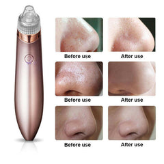 Electric Blackhead Remover Pore Vacuum Suction Diamond Dermabrasion Face Cleaner