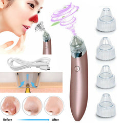 Electric Blackhead Remover Pore Vacuum Suction Diamond Dermabrasion Face Cleaner